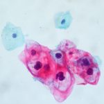 BİZİ KANSER YAPAN MİKROPLAR