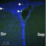 05: NEDİR BU KÖK HÜCRELERİ?