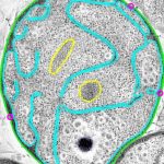 Ökaryotlar kulübüne giremeyen bakteri