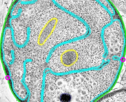 Ökaryotlar kulübüne giremeyen bakteri