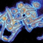 DAHA YAKIN OLMAK İÇİN: ELEKTRON MİKROSKOPLARI