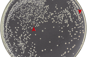 Şekil 5. Dirençli (beyaz) koli basilleriyle dirençsizlerin (kırmızı) gama ışınları altındaki yarışından dirençliler galip çıkıyor. Dirençli (beyaz) bakteri kolonileri her yere yayılmışken, dirençsiz (kırmızı) kolonilerden topu topu 2 tane görülebiliyor (kırmızı okla işaretli). (Byrne vd., 2014’ten değiştirilerek alındı.)