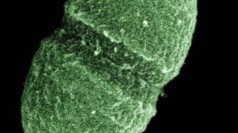 Şekil 2. İnsan bağırsağında yaşayan mikroorganizmalardan Enterococcus faecalis. (Fotoğraf: ABD Tarım Bakanlığı)