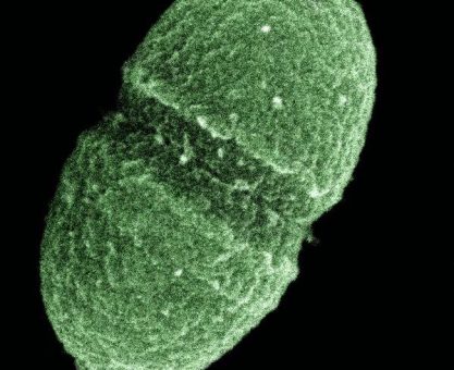 Şekil 2. İnsan bağırsağında yaşayan mikroorganizmalardan Enterococcus faecalis. (Fotoğraf: ABD Tarım Bakanlığı)