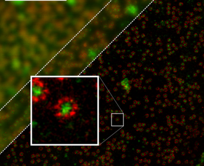 Şekil 5. Eşodaklı mikroskop görüntüsüyle STED görüntüsünün mukayesesi.