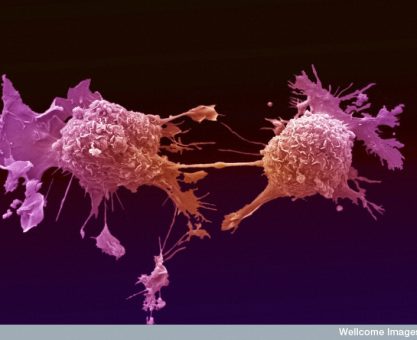 Akciğer kanserine çok yakından bakış